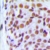 Polyclonal Rabbit anti-Human PRPF6 / TOM Antibody (C-Terminus, IHC, WB)