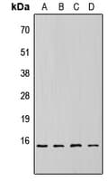 EIF4EBP1 / 4EBP1 Antibody (phospho-Thr69)