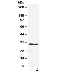 Polyclonal Rabbit anti-Mouse HNE / Neutrophil Elastase Antibody (IHC, WB)