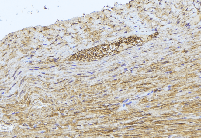 Polyclonal Rabbit anti-Human GCLM Antibody (IHC, WB)