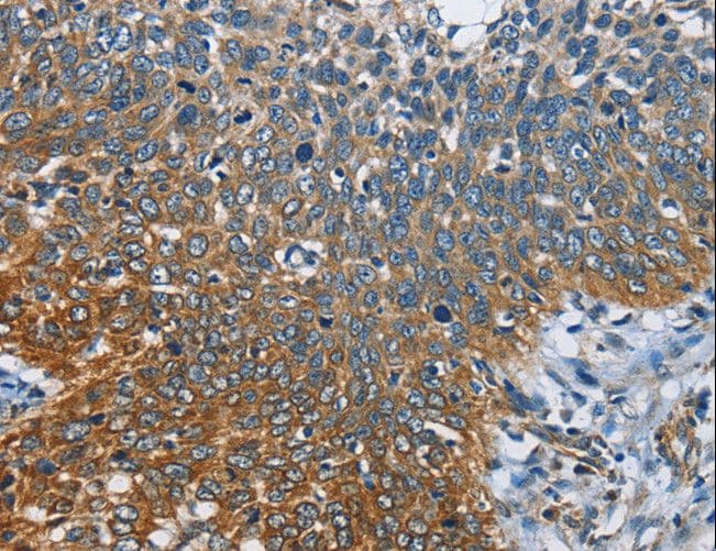 Polyclonal Rabbit anti-Human CARD9 Antibody (IHC)