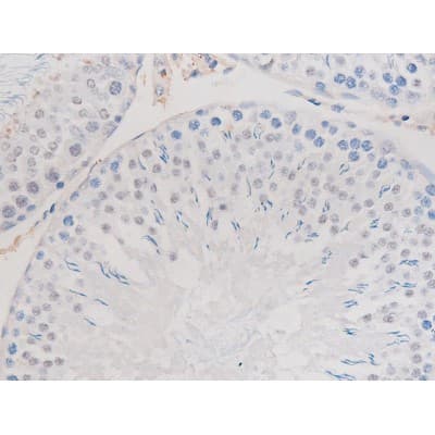 ADD1 / Adducin Alpha Antibody (phospho-Ser726)