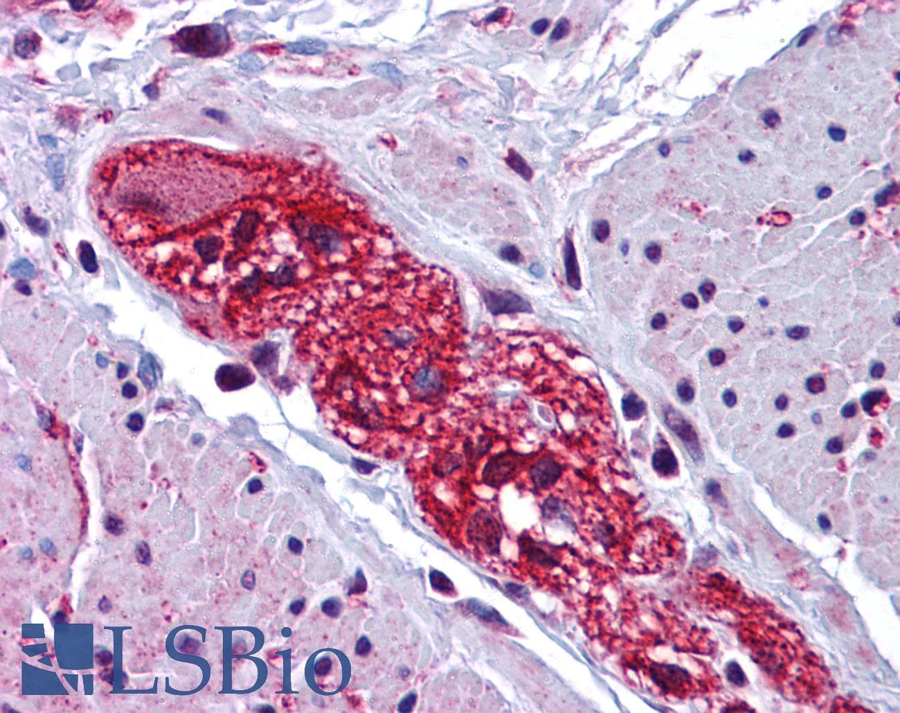 IHC-plus™ Polyclonal Rabbit anti-Human CABP7 Antibody (IHC, IF, WB)
