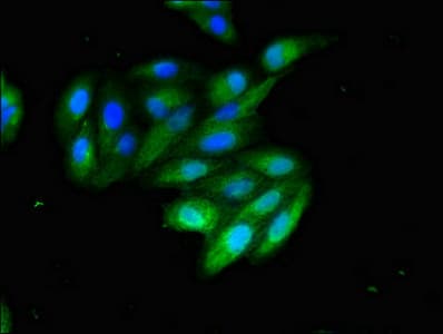 CD209 / DC-SIGN Antibody