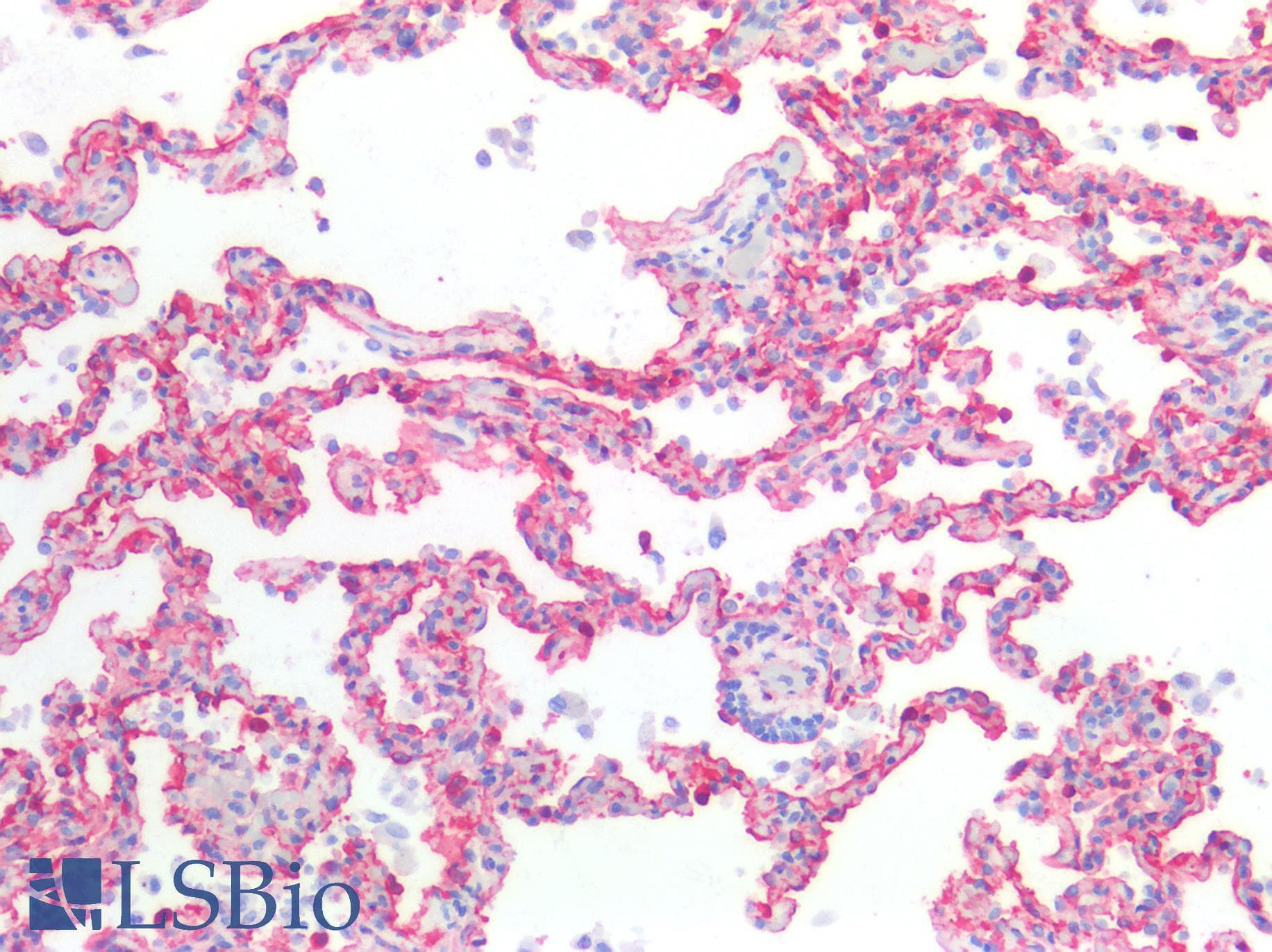 IHC-plus™ CAV1 / Caveolin 1 Antibody (N-Terminus)