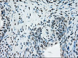 ERCC1 Antibody (clone OTI1A3)