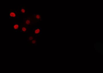 Polyclonal Rabbit anti-Human CHAF1B / CAF1 Antibody (IF, WB)