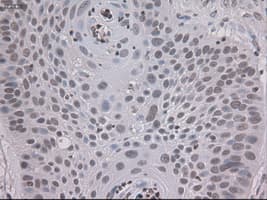STAT3 Antibody (clone OTI21E7)
