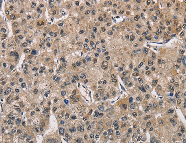PGK1 / Phosphoglycerate Kinase Antibody
