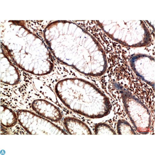 ATM Antibody