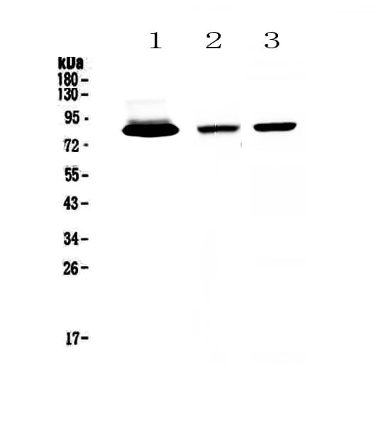 Polyclonal Rabbit anti-Human LF / LTF / Lactoferrin Antibody (IHC, WB)