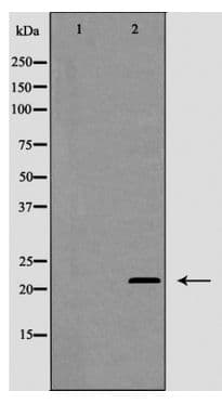 MGMT Antibody