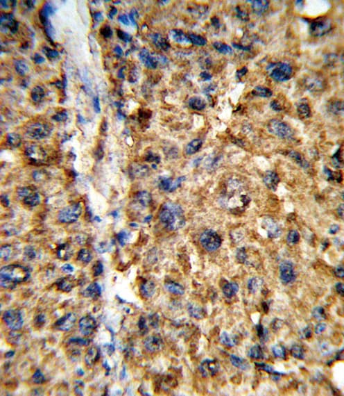 Polyclonal Rabbit anti-Human GSTA2 Antibody (aa1-30, IHC, WB)