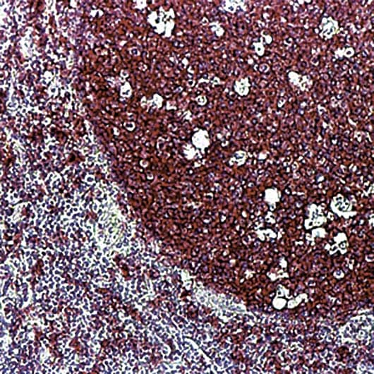 CD20 Antibody (clone L26)