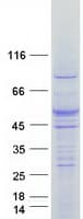 Human FLVCR2 Protein (Recombinant Myc-DDK (Flag))