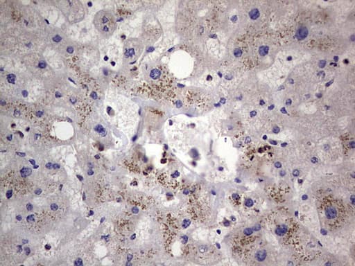 Monoclonal Mouse anti-Human PKM2 Antibody (clone 1F12, IHC, WB)