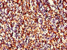 Polyclonal Rabbit anti-Human HLA-B Antibody (Biotin, IHC, WB)