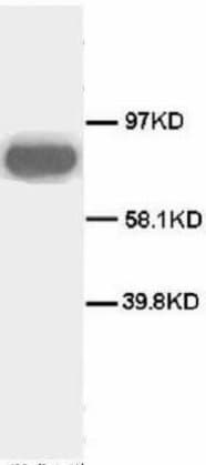 CD71 / Transferrin Receptor Antibody (N-Terminus, Magnetic beads)