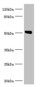 ANXA11 / Annexin XI Antibody (aa276-505)