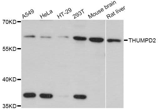 Polyclonal Rabbit anti-Human THUMPD2 Antibody (WB)