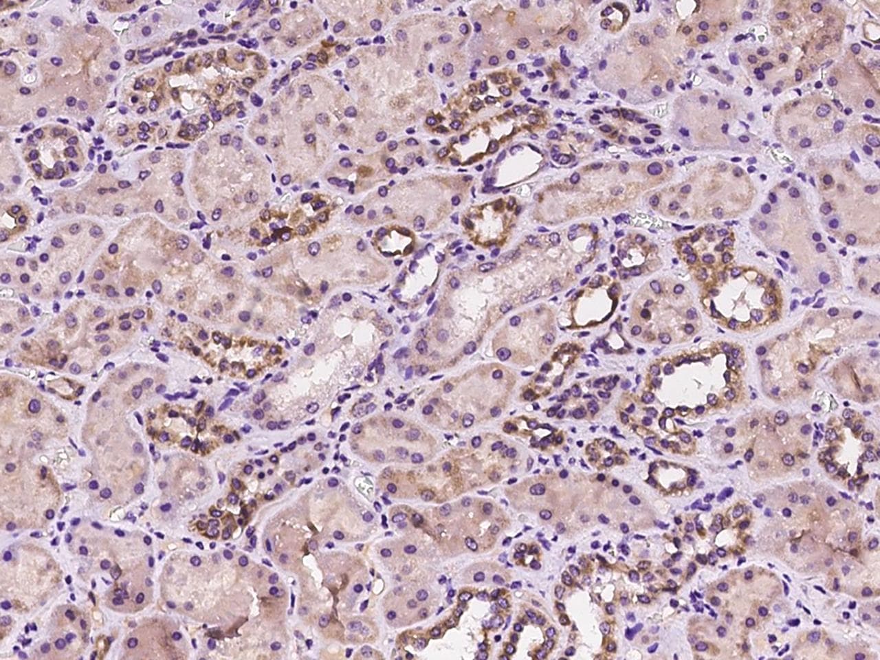 CX3CL1 / Fractalkine Antibody