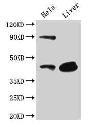 Polyclonal Rabbit anti-Human CD46 Antibody (IHC, WB)
