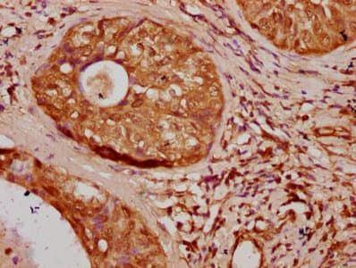HIST1H1E Antibody