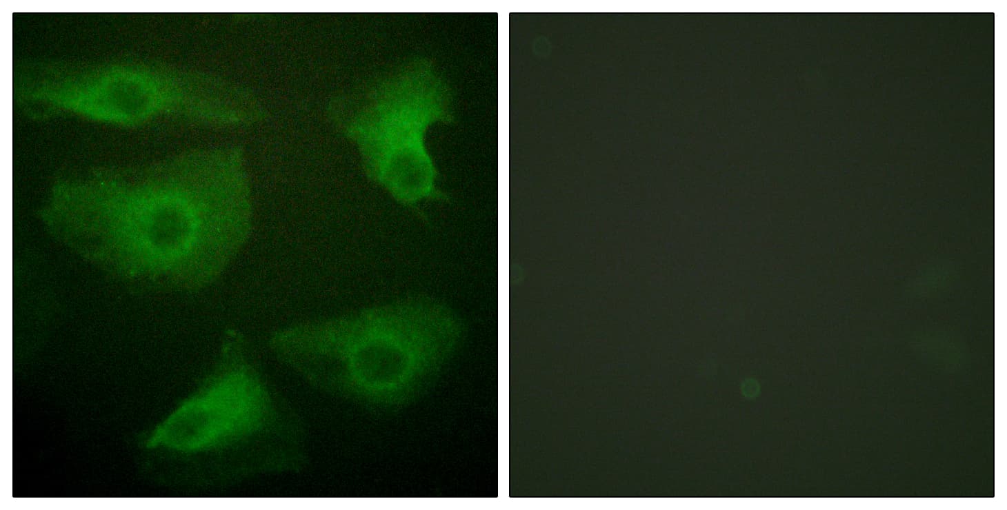 NFKBIE / IKB Epsilon Antibody (phospho-Ser22)
