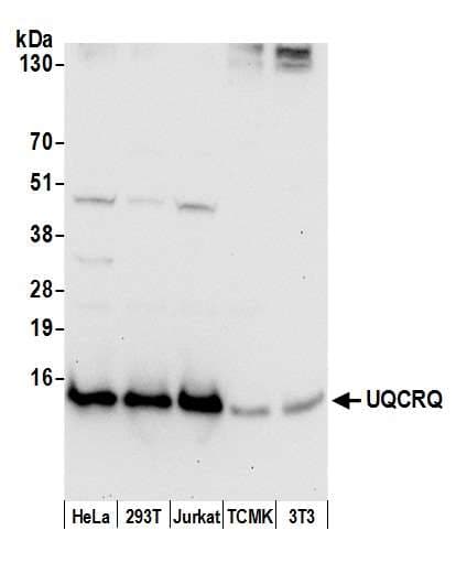 Polyclonal Rabbit anti-Human UQCRQ Antibody (aa32-82, IHC, WB)