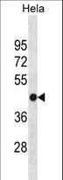 Polyclonal Rabbit anti-Human FH / Fumarase / MCL Antibody (aa107-135, WB)