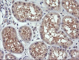 Monoclonal Mouse anti-Human TCL / RHOJ Antibody (clone OTI2C10, IHC, IF, WB)