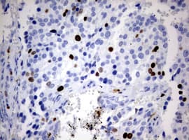 Monoclonal Mouse anti-Human MKI67 / Ki67 Antibody (clone OTI14G1, aa1160-1493, IHC)