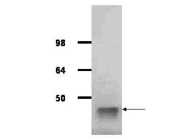 IHC-plus™ ALDOA / Aldolase A Antibody (Lyophilized)