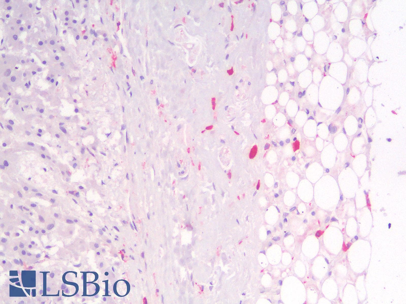 PathPlus™ Polyclonal Rabbit anti-Human CD163 Antibody (IHC)