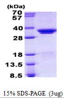 Human SRSF1 / SF2 Protein (Recombinant His)