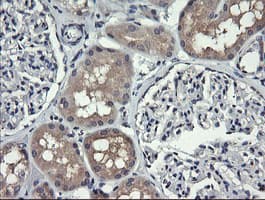 Monoclonal Mouse anti-Human HRAS / H-Ras Antibody (clone OTI1A1, IHC, IF, WB)