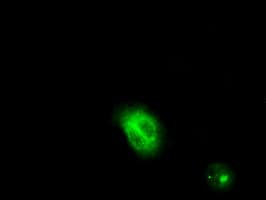 LIPG / Endothelial Lipase Antibody (clone OTI4A8)
