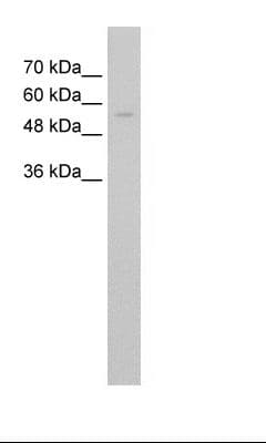 Polyclonal Rabbit anti-Human IRX3 Antibody (aa386-435, IHC, WB)