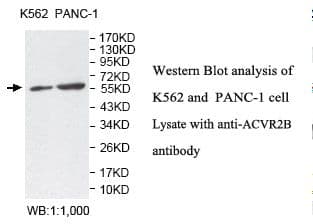 ACTRIIB / ACVR2B Antibody (aa22-264)