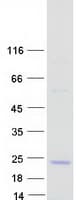Human OBP2A Protein (Recombinant Myc-DDK (Flag))