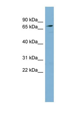 Polyclonal Rabbit anti-Human SLC7A2 Antibody (aa215-264, WB)