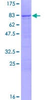Human TDG / Thymine DNA Glycosylase Protein (Recombinant GST)