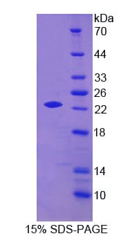 Human APOO / Apolipoprotein O (Recombinant His)