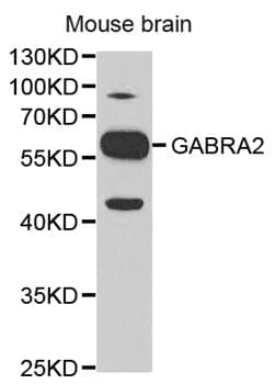 Polyclonal Rabbit anti-Human GABRA2 Antibody (IHC, WB)