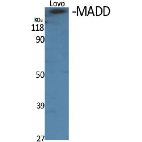 DENN / MADD Antibody (720-800 aa, Internal)