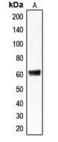 CLCC1 Antibody (Internal)