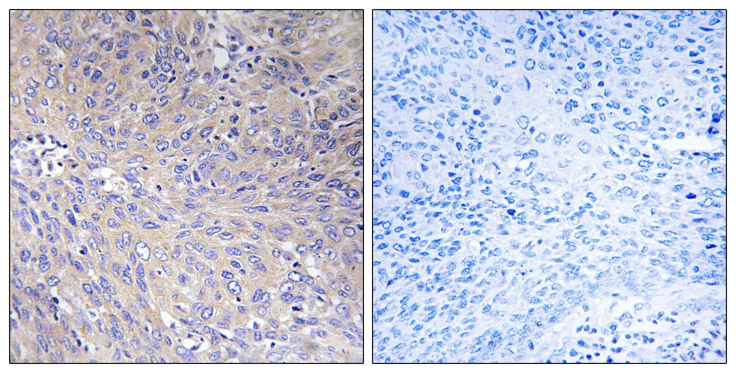 MRPL11 Antibody