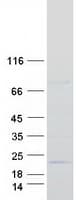 Human PRR13 Protein (Recombinant Myc-DDK (Flag))