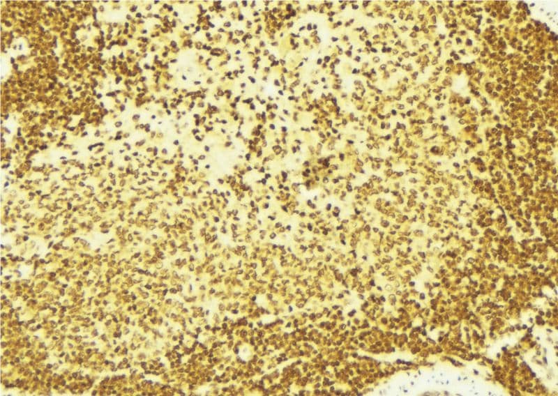 C/EBP Beta / CEBPB Antibody