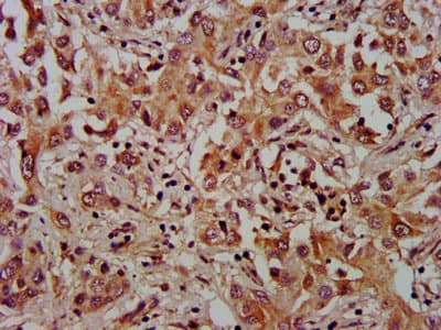 XRG8 / XKR8 Antibody
